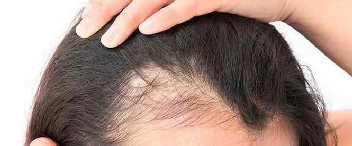 Thick Hair Areas