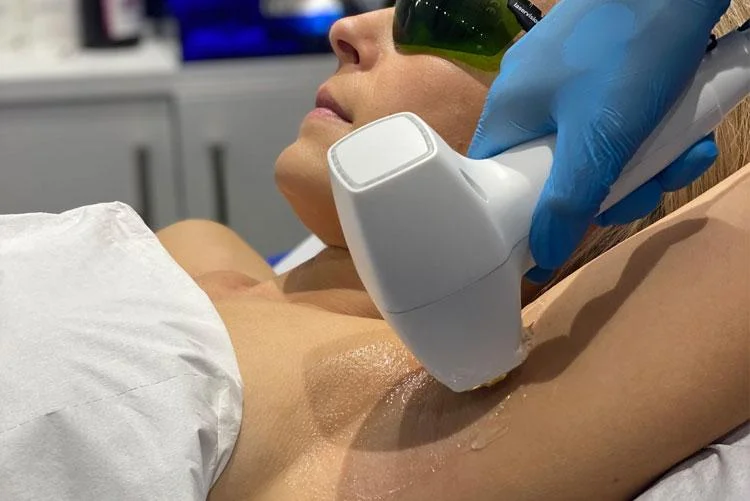 Underarm Laser