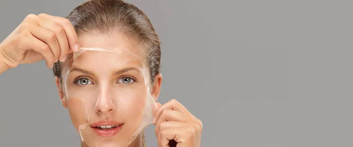 Chemical Peels