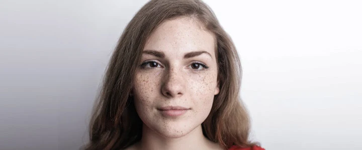 Pigmentation Support